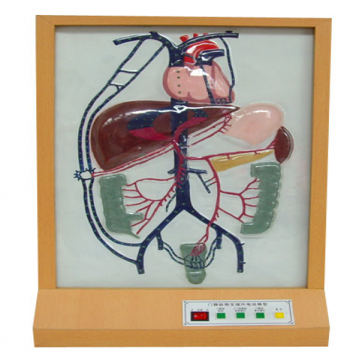  電動(dòng)門(mén)靜脈側(cè)支循環(huán)模型